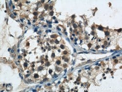NRAS Rabbit anti-Human, Mouse, Rat, Polyclonal, Proteintech