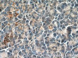 NRAS Rabbit anti-Human, Mouse, Rat, Polyclonal, Proteintech:Antibodies:Primary
