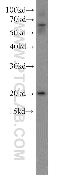 NRAS Rabbit anti-Human, Mouse, Rat, Polyclonal, Proteintech:Antibodies:Primary