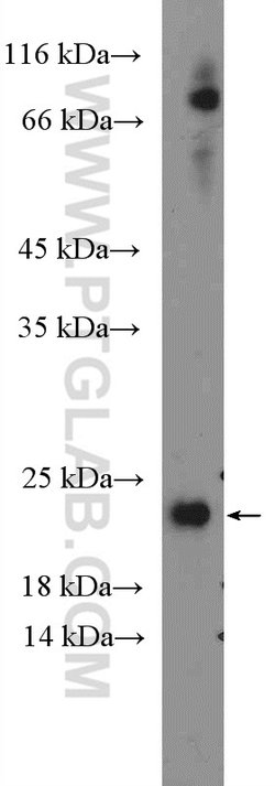 NRAS Rabbit anti-Human, Mouse, Rat, Polyclonal, Proteintech:Antibodies:Primary