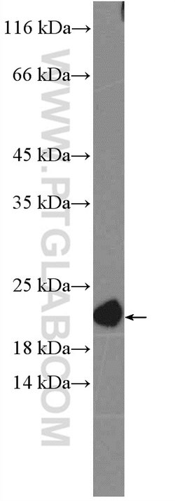 NRAS Rabbit anti-Human, Mouse, Rat, Polyclonal, Proteintech:Antibodies:Primary
