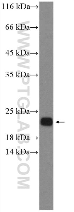 NRAS Rabbit anti-Human, Mouse, Rat, Polyclonal, Proteintech:Antibodies:Primary