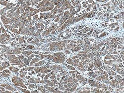 AKR7A2 Rabbit anti-Human, Mouse, Polyclonal, Proteintech 150 &mu;L; Unconjugated:Antibodies,