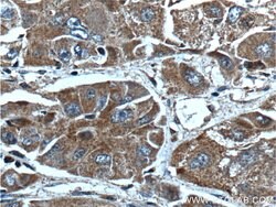 AKR7A2 Rabbit anti-Human, Mouse, Polyclonal, Proteintech 150 &mu;L; Unconjugated:Antibodies,