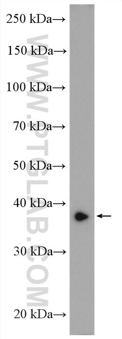AKR7A2 Rabbit anti-Human, Mouse, Polyclonal, Proteintech 150 &mu;L; Unconjugated:Antibodies,