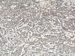 Thumbnail_MGP Rabbit anti-Human, Polyclonal, Proteintech 150 &mu;L; Unconjugated:Antikörper