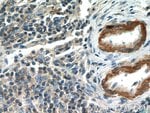 Thumbnail_MGP Rabbit anti-Human, Polyclonal, Proteintech 150 &mu;L; Unconjugated:Antikörper