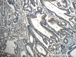 TPM3 Rabbit anti-Human, Mouse, Rat, Polyclonal, Proteintech 150 &mu;L;