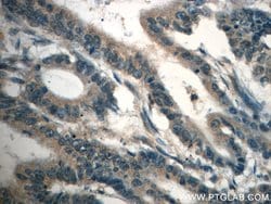 TPM3 Rabbit anti-Human, Mouse, Rat, Polyclonal, Proteintech 150 &mu;L;