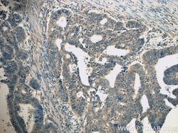 TPM3 Rabbit anti-Human, Mouse, Rat, Polyclonal, Proteintech 150 &mu;L;