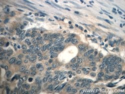 TPM3 Rabbit anti-Human, Mouse, Rat, Polyclonal, Proteintech 150 &mu;L;