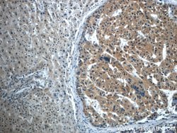 TPM3 Rabbit anti-Human, Mouse, Rat, Polyclonal, Proteintech 150 &mu;L;