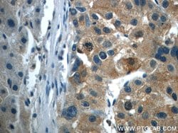 TPM3 Rabbit anti-Human, Mouse, Rat, Polyclonal, Proteintech 150 &mu;L;