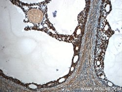 TPM3 Rabbit anti-Human, Mouse, Rat, Polyclonal, Proteintech 150 &mu;L;