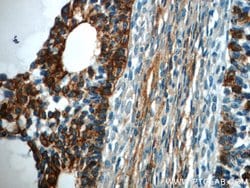 TPM3 Rabbit anti-Human, Mouse, Rat, Polyclonal, Proteintech 150 &mu;L;