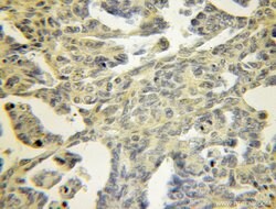 TPM3 Rabbit anti-Human, Mouse, Rat, Polyclonal, Proteintech 150 &mu;L;