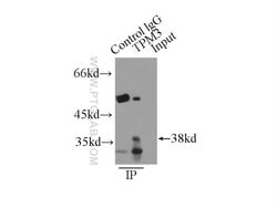 TPM3 Rabbit anti-Human, Mouse, Rat, Polyclonal, Proteintech 150 &mu;L;