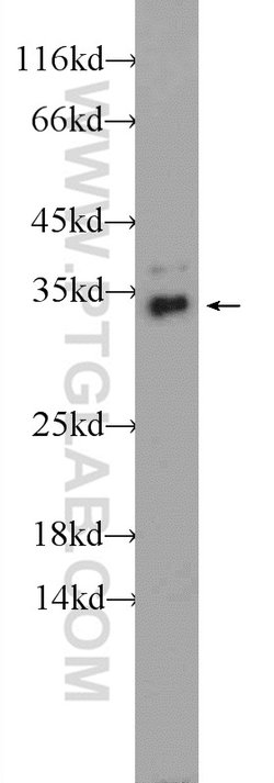 TPM3 Rabbit anti-Human, Mouse, Rat, Polyclonal, Proteintech 150 &mu;L;