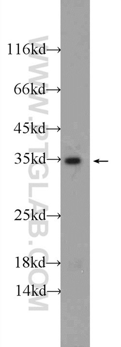 TPM3 Rabbit anti-Human, Mouse, Rat, Polyclonal, Proteintech 150 &mu;L;