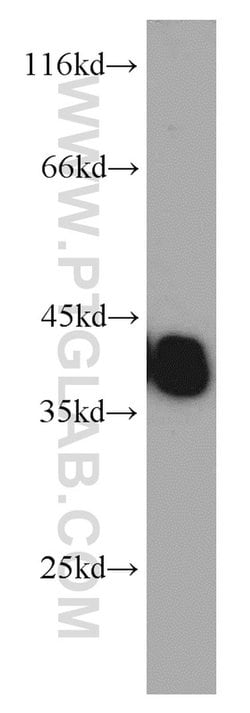 TPM3 Rabbit anti-Human, Mouse, Rat, Polyclonal, Proteintech 150 &mu;L;