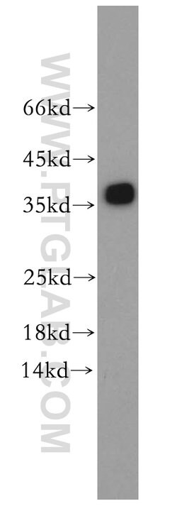 TPM3 Rabbit anti-Human, Mouse, Rat, Polyclonal, Proteintech 150 &mu;L;