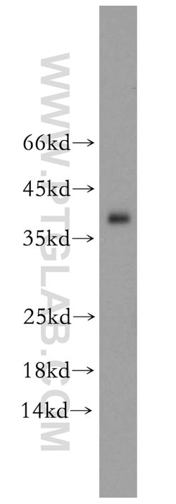 TPM3 Rabbit anti-Human, Mouse, Rat, Polyclonal, Proteintech 150 &mu;L;