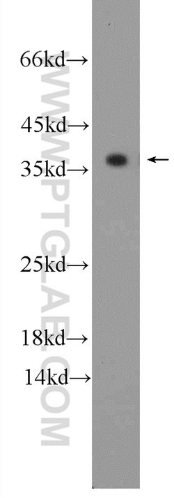 TPM3 Rabbit anti-Human, Mouse, Rat, Polyclonal, Proteintech 150 &mu;L;