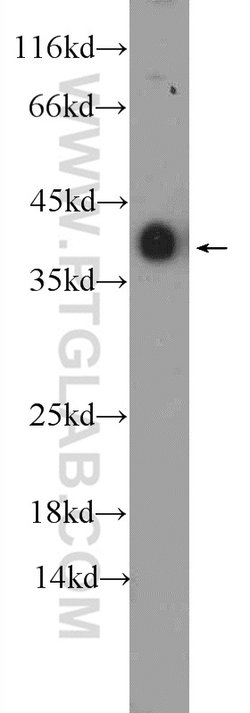 TPM3 Rabbit anti-Human, Mouse, Rat, Polyclonal, Proteintech 150 &mu;L;
