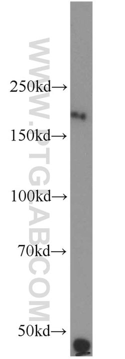 RTN4/NOGO Rabbit anti-Human, Mouse, Polyclonal, Proteintech 150 &mu;L;