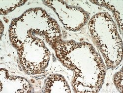 LKB1 Rabbit anti-Human, Mouse, Rat, Polyclonal, Proteintech:Anticuerpos:Anticuerpos