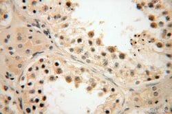 LKB1 Rabbit anti-Human, Mouse, Rat, Polyclonal, Proteintech:Anticuerpos:Anticuerpos