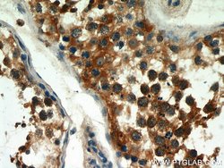 LKB1 Rabbit anti-Human, Mouse, Rat, Polyclonal, Proteintech:Anticuerpos:Anticuerpos