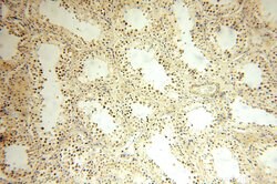 LKB1 Rabbit anti-Human, Mouse, Rat, Polyclonal, Proteintech:Anticuerpos:Anticuerpos