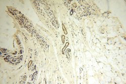 LKB1 Rabbit anti-Human, Mouse, Rat, Polyclonal, Proteintech:Anticuerpos:Anticuerpos