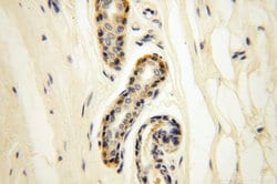 LKB1 Rabbit anti-Human, Mouse, Rat, Polyclonal, Proteintech:Anticuerpos:Anticuerpos