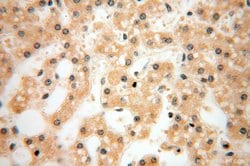 LKB1 Rabbit anti-Human, Mouse, Rat, Polyclonal, Proteintech:Anticuerpos:Anticuerpos