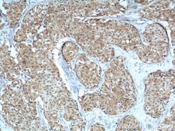 LKB1 Rabbit anti-Human, Mouse, Rat, Polyclonal, Proteintech:Anticuerpos:Anticuerpos