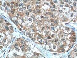 LKB1 Rabbit anti-Human, Mouse, Rat, Polyclonal, Proteintech:Anticuerpos:Anticuerpos