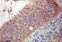 DARPP32 Rabbit anti-Human, Mouse, Rat, Polyclonal, Proteintech 150 &mu;L;