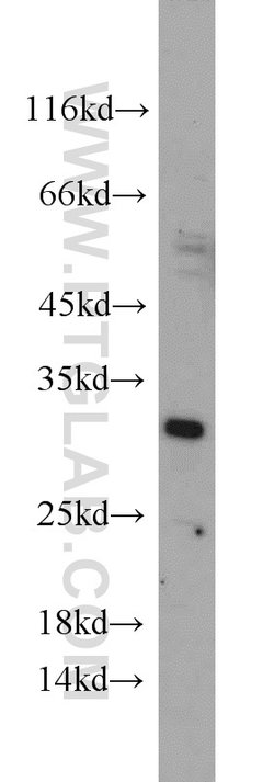 DARPP32 Rabbit anti-Human, Mouse, Rat, Polyclonal, Proteintech 150 &mu;L;