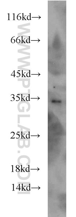 DARPP32 Rabbit anti-Human, Mouse, Rat, Polyclonal, Proteintech 150 &mu;L;