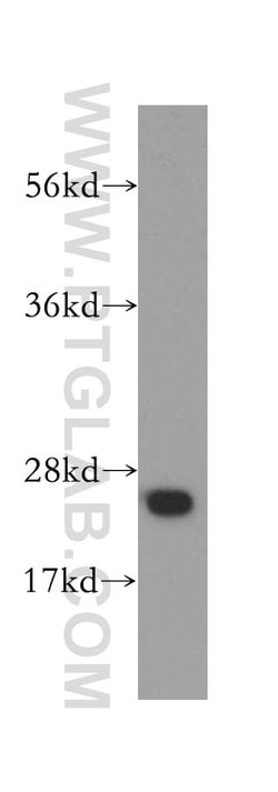 DARPP32 Rabbit anti-Human, Mouse, Rat, Polyclonal, Proteintech 150 &mu;L;