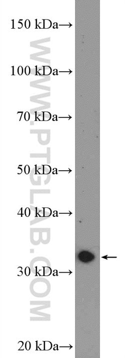 DARPP32 Rabbit anti-Human, Mouse, Rat, Polyclonal, Proteintech 150 &mu;L;