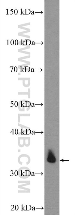 DARPP32 Rabbit anti-Human, Mouse, Rat, Polyclonal, Proteintech 150 &mu;L;