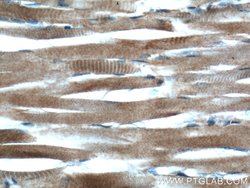UCP3 Rabbit anti-Human, Mouse, Rat, Polyclonal, Proteintech 150 &mu;L;