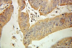 UCP3 Rabbit anti-Human, Mouse, Rat, Polyclonal, Proteintech 150 &mu;L;