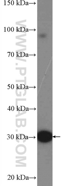 UCP3 Rabbit anti-Human, Mouse, Rat, Polyclonal, Proteintech 150 &mu;L;