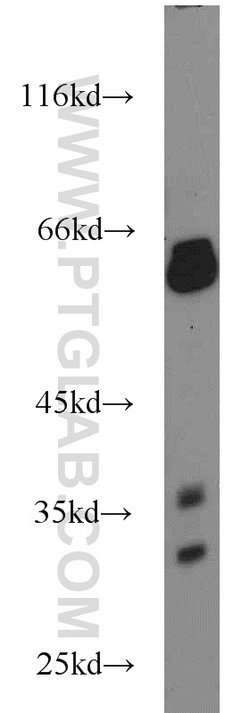UCP3 Rabbit anti-Human, Mouse, Rat, Polyclonal, Proteintech 150 &mu;L;