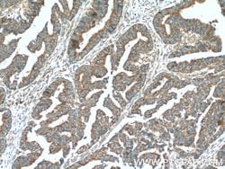 NIPSNAP3A Rabbit anti-Human, Mouse, Rat, Polyclonal, Proteintech 150 &mu;L;