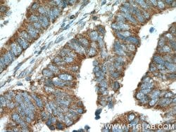 NIPSNAP3A Rabbit anti-Human, Mouse, Rat, Polyclonal, Proteintech 150 &mu;L;